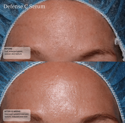 Defense C Serum