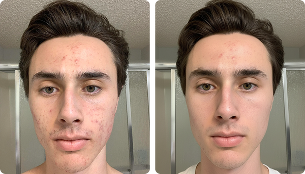 Transformation preview